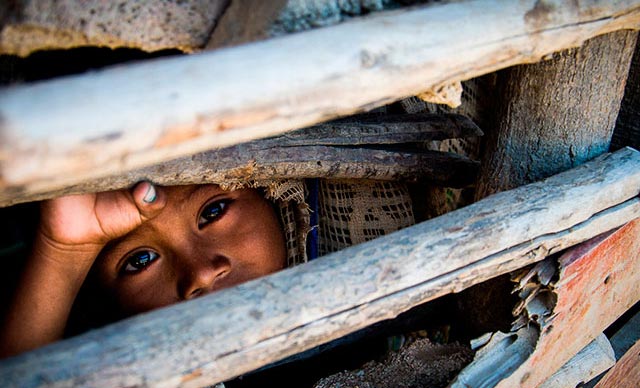 La desnutrición infantil en la Guajira venezolana